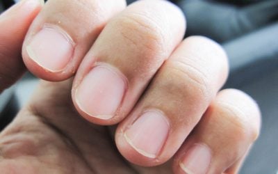 The Surprising Things Your Fingernails Say About Your Health