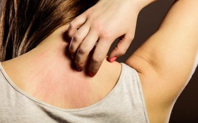 Why Do We Itch? (and how to help that itch!)