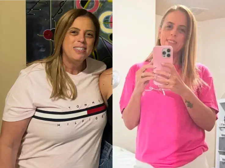 Before and after
