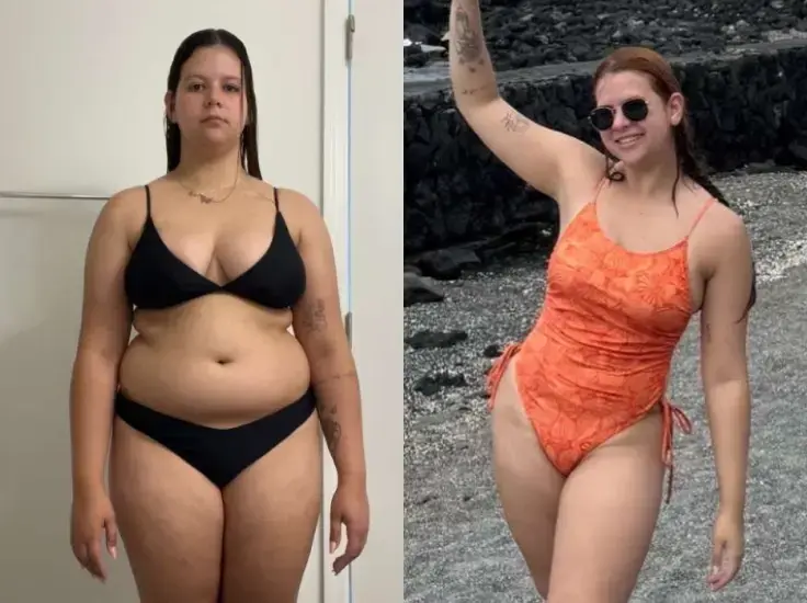 Before and after