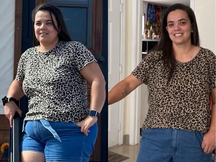 Before and after