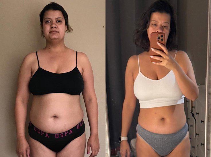 Before and after